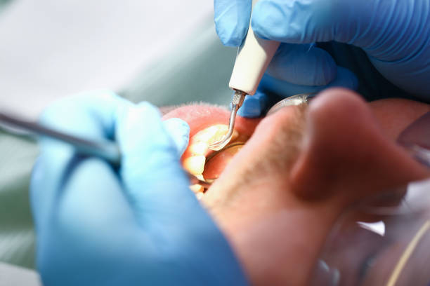 Best Emergency Care for Gum Disease in Decordova, TX