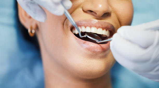 Best Emergency Cosmetic Dentistry (e.g., broken veneers) in Decordova, TX