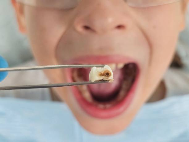 Best Weekend Emergency Dental Services in Decordova, TX